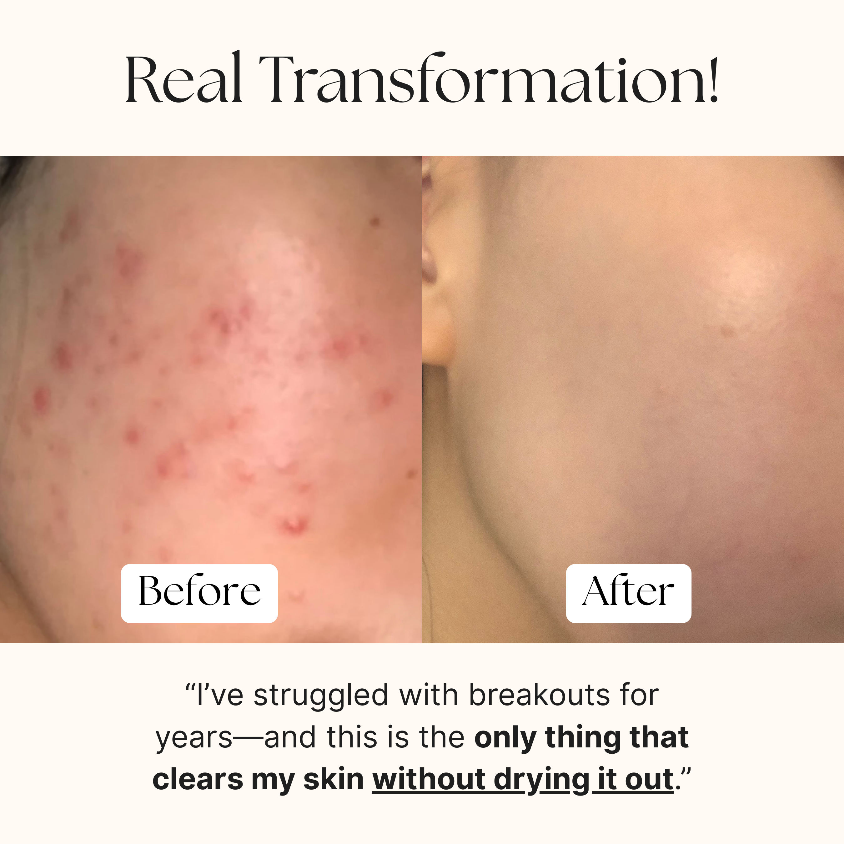 Purple Gromwell Clarifying Luxury Cleansing Bar