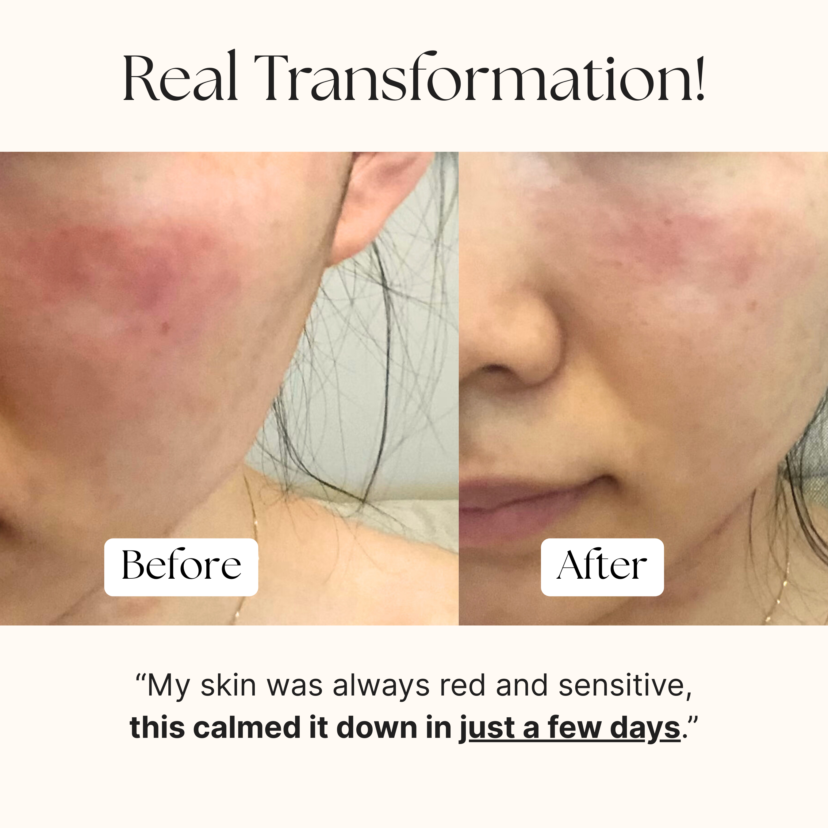 Calm Redness Routine