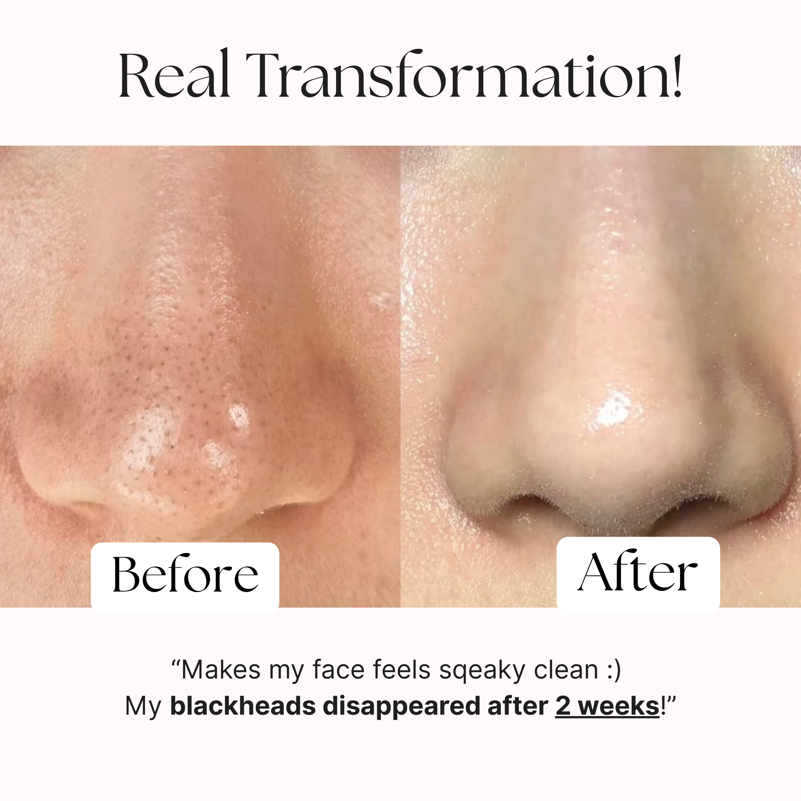 Charcoal Purifying Luxury Cleansing Bar