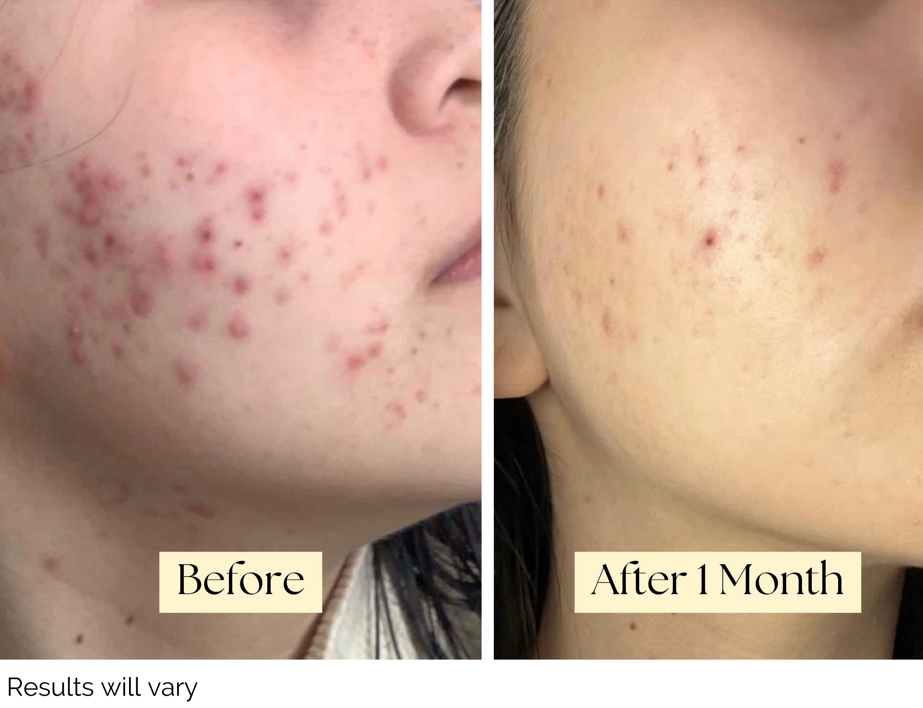 Personalized Skincare Box