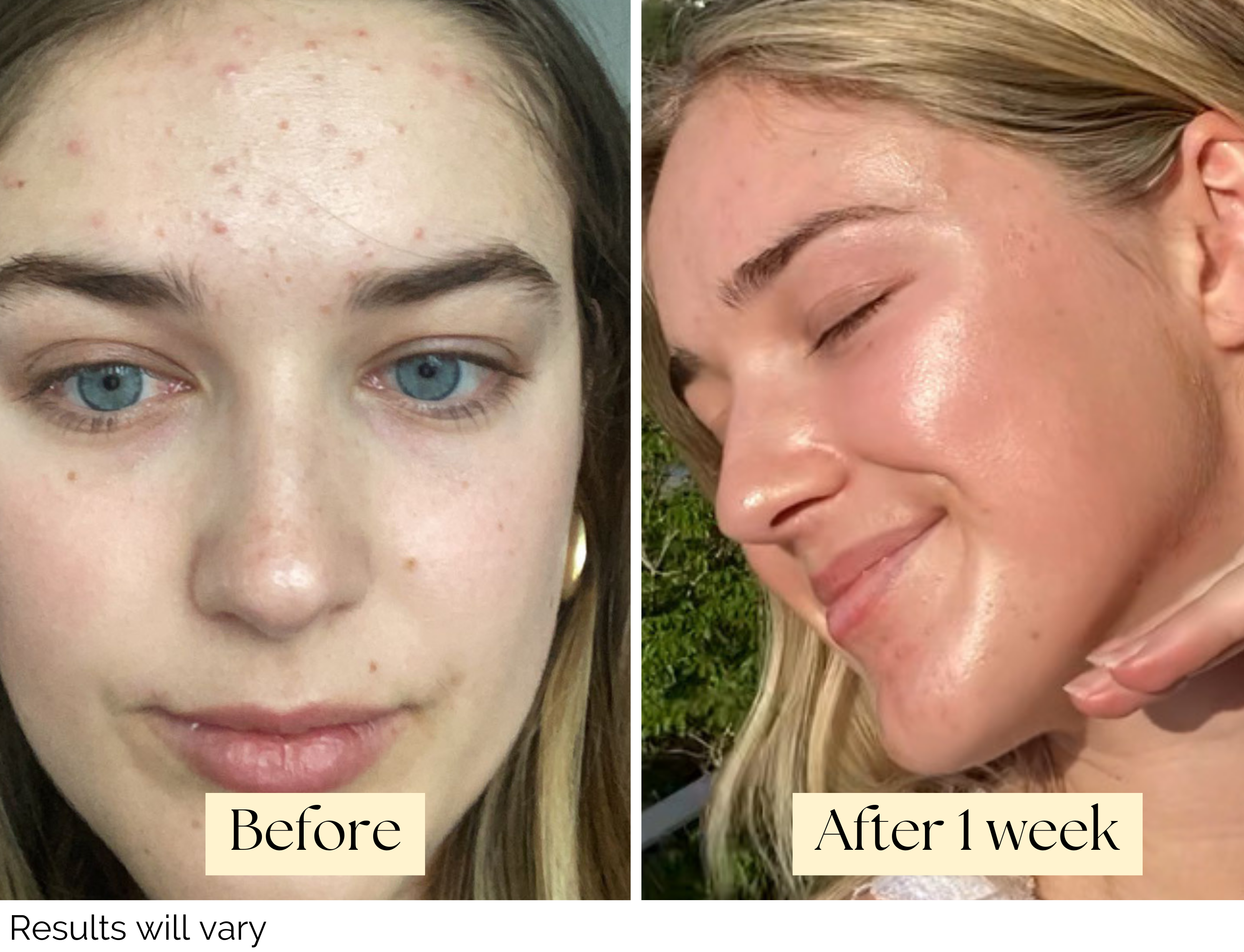 Personalized Skincare Box