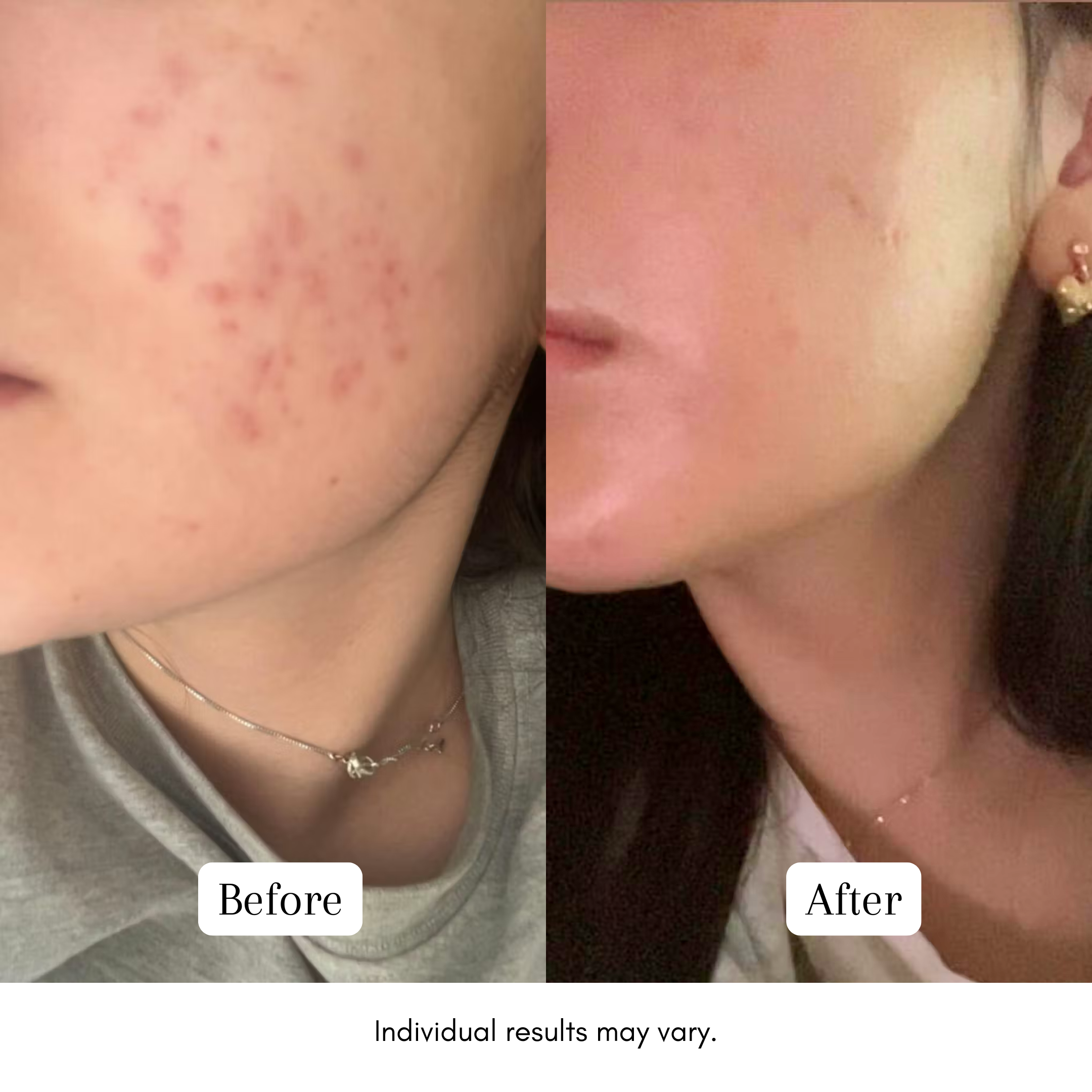 Calm Redness Routine