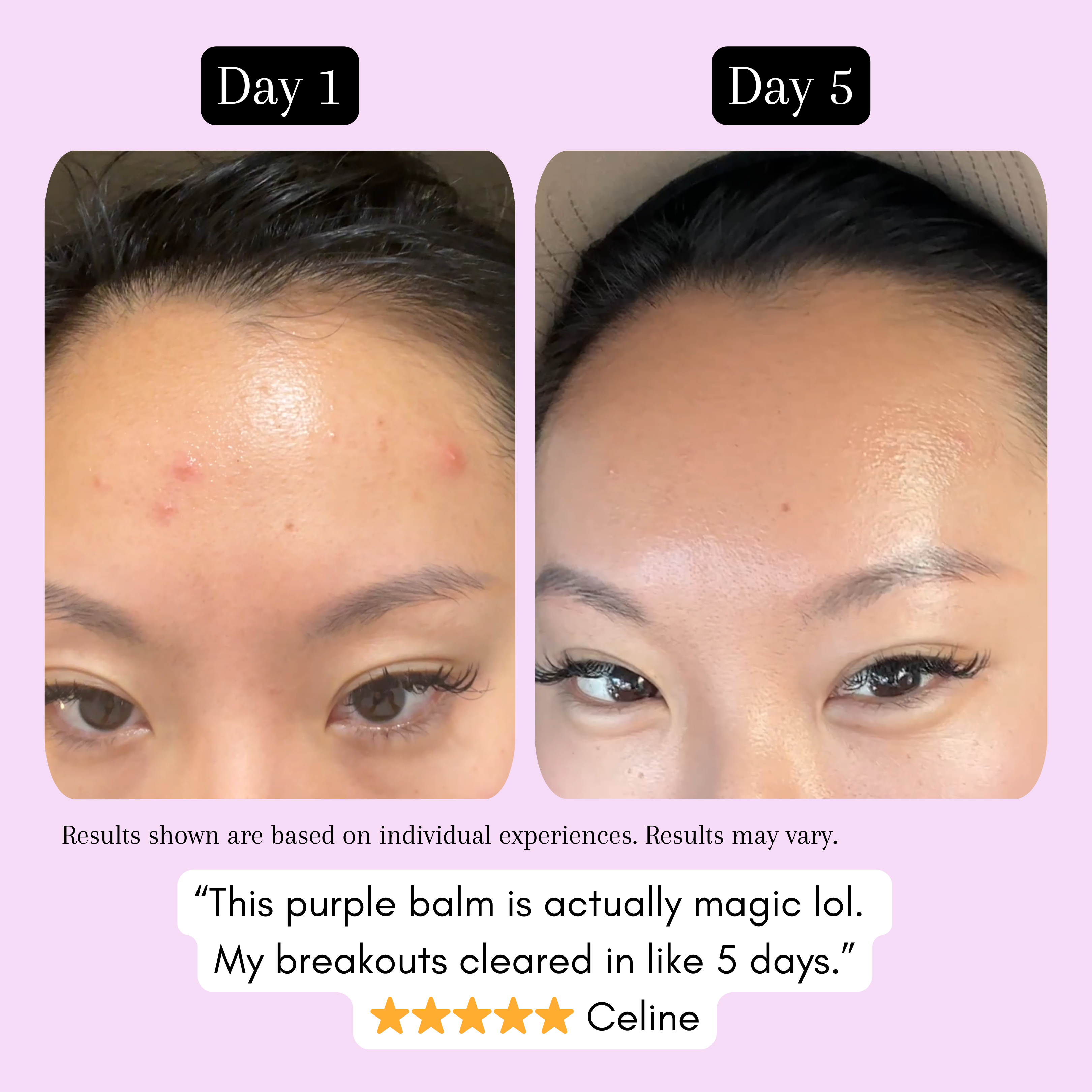 Purple Rescue Treatment