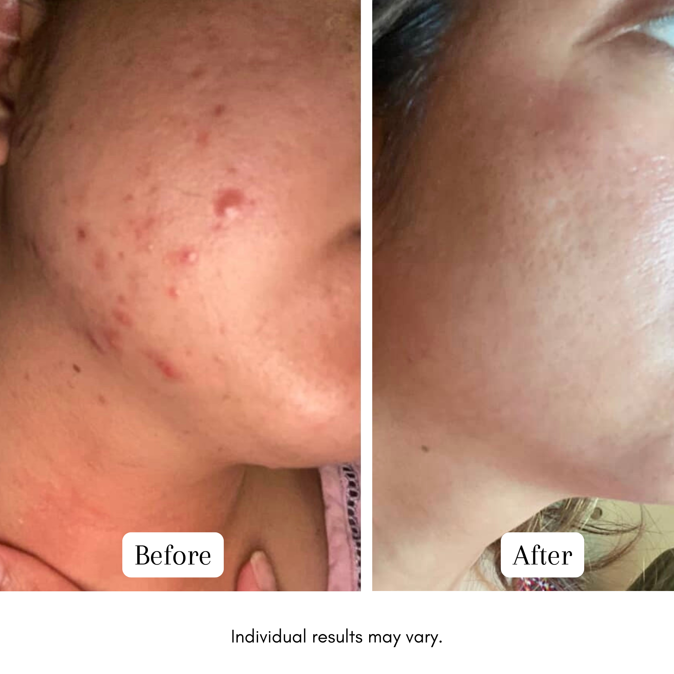 Purple Gromwell Clarifying Luxury Cleansing Bar