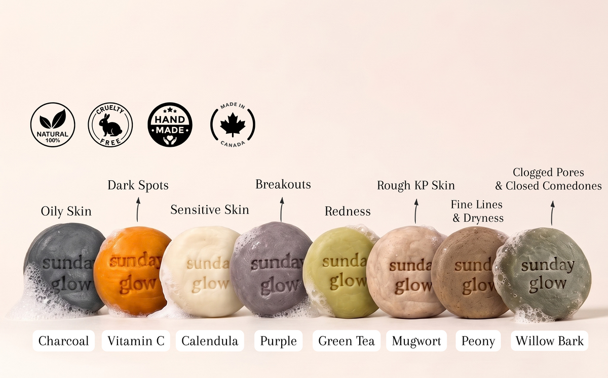 A row of round handmade skincare bars labeled 'sunday glow' with ingredient names underneath: Charcoal, Vitamin C, Calendula, Purple, Green Tea, Mugwort, Peony, and Willow Bark. Above the bars are black certification-style icons and text pointing to skin concerns like oily skin, dark spots, breakouts, redness, rough KP skin, and clogged pores.