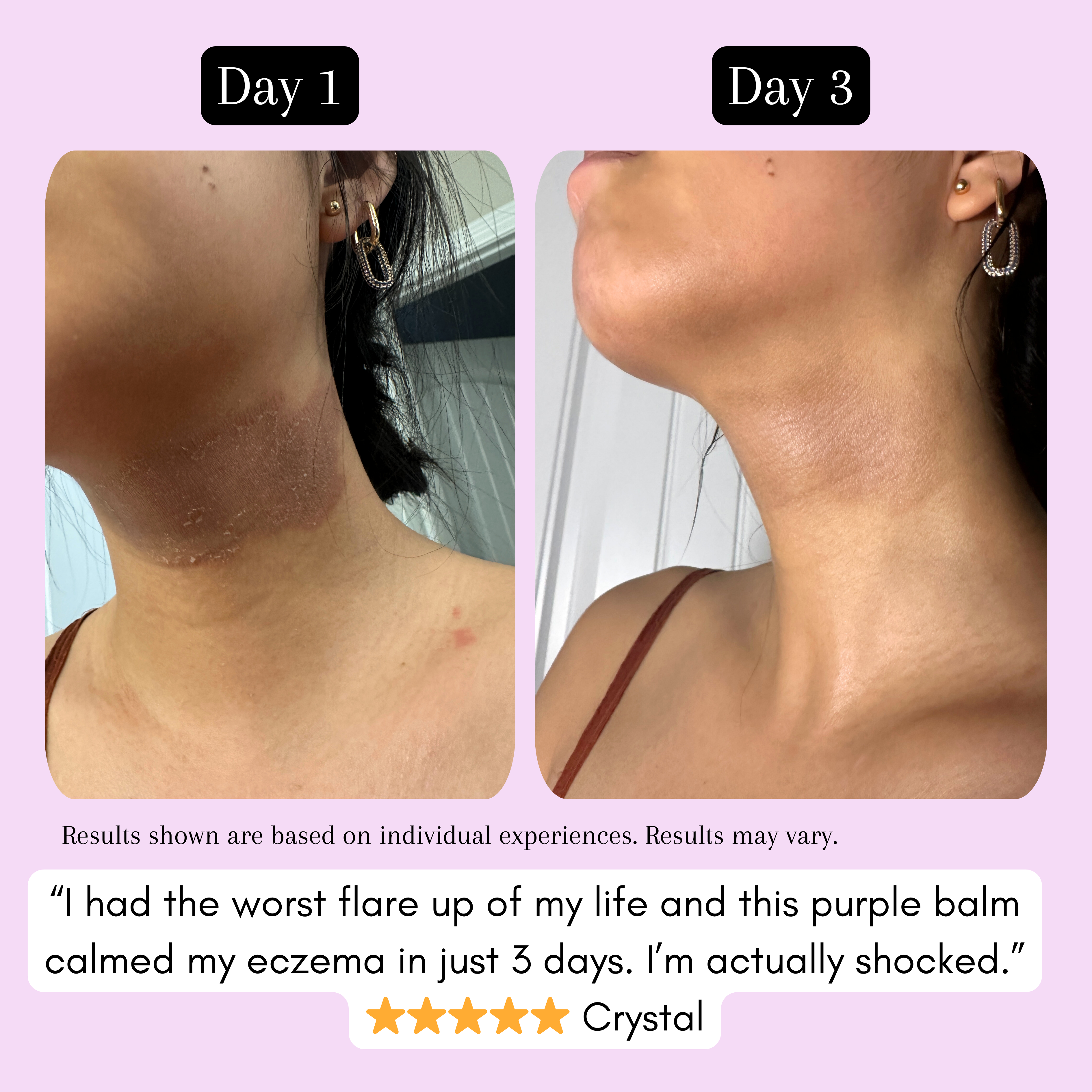 Purple Rescue Treatment