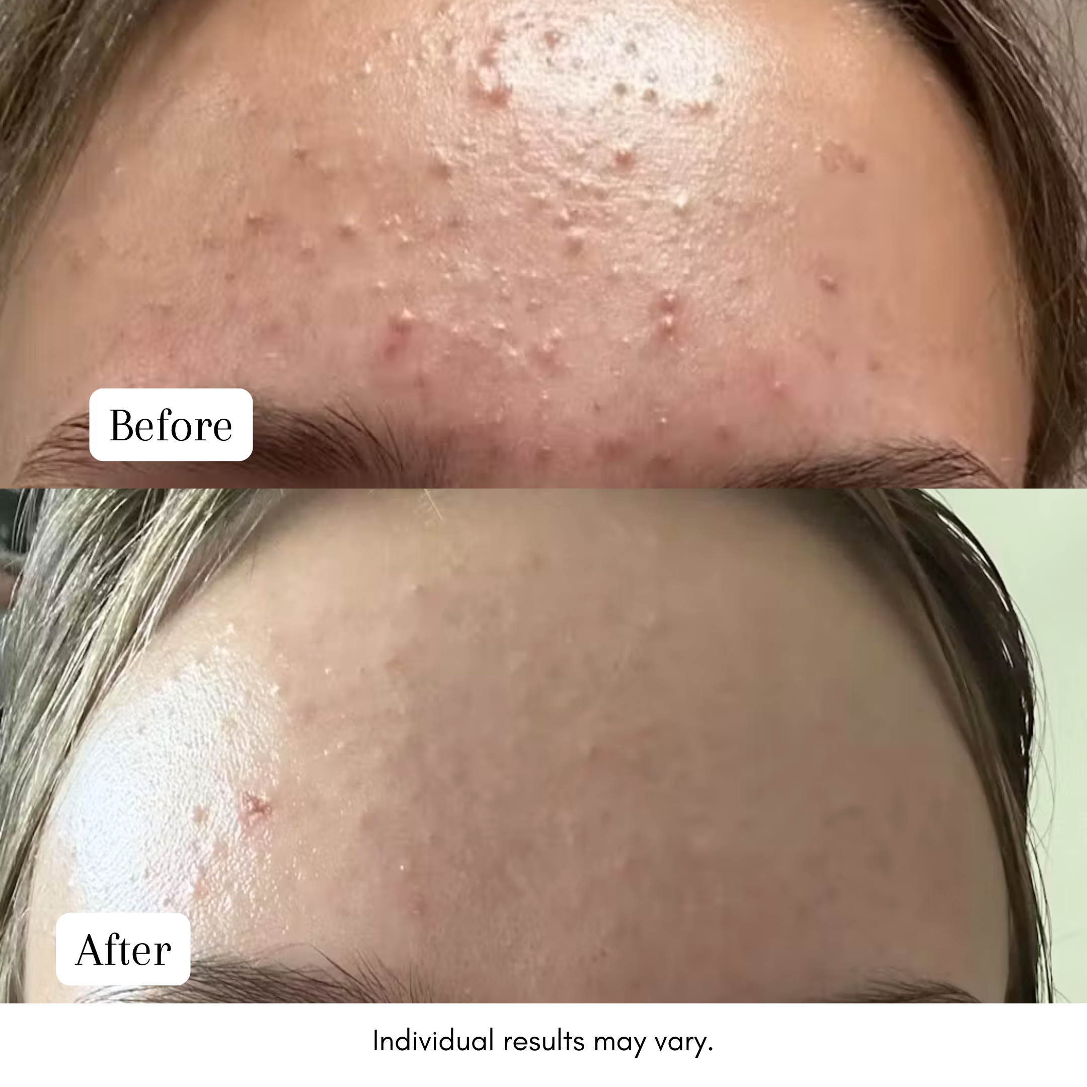 Purple Gromwell Clarifying Luxury Cleansing Bar