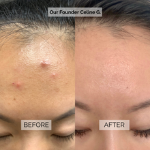 Load image into Gallery viewer, Acne Prevention Mask Box (Value $44)
